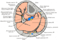 Color illustration of the soleus muscle