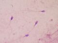 Sperm stained