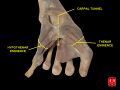 Dissection of the hand showing the thenar muscles