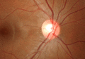 3D motion parallax of optic cup and macula