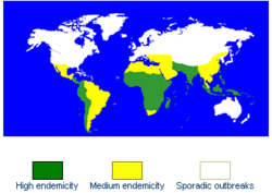 Typhoid fever