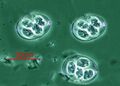 Eimeria maxima oocysts
