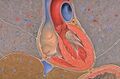 Coronal section of the heart