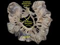Intestinal arteries.