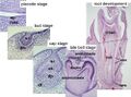 Histology of important stages of tooth development