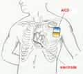 AICD