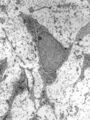Mesenchymal stem cells at high magnification