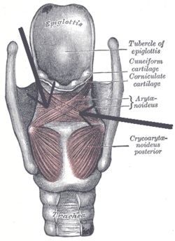 Musculusarytenoideus
