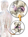 Diagram of facet joints