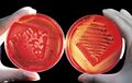 Agar plate with red blood cells