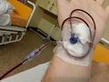 Blood transfusion