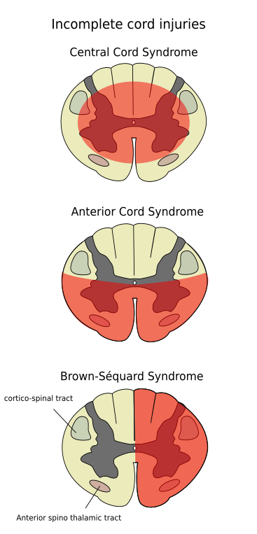 Diagram of the spinal cord