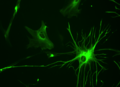 Human Astrocyte