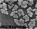 Staphylococcus aureus under a microscope
