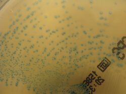 Streptococcus agalactiae