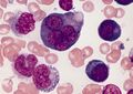 Multinucleated erythroblast