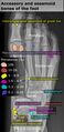 Accessory and sesamoid bones of the foot - dorsoplantar projection