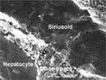 Liver sinusoid