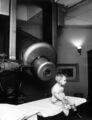 External beam radiotherapy for retinoblastoma