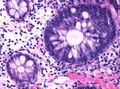 Non-proliferative versus proliferative colonic crypts