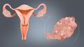 Ovary