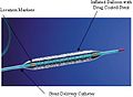 Coronary stent