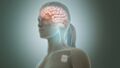 Vagus nerve stimulation device