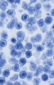 Gammaretrovirus