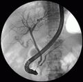 ERCP Roentgen