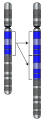 Gene duplication