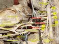 Anatomical diagram of the brachial plexus