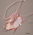 Lipofuscin in a neuron
