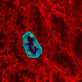 Nephron
