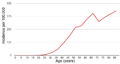 Breast cancer incidence by age in women in the UK (2006-2008)