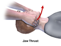 Basic airway management