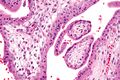 Chorionic villi - very high magnification