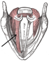 Thyroarytenoid muscle diagram
