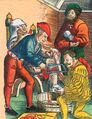 Historical depiction of an amputation in 1540