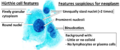 Cytopathology suspicious for Hürthle cell neoplasm