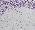 Enterococcus faecalis culture