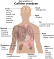 Main symptoms of Caffeine overdose