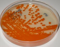 Streptococcus agalactiae on Granada medium
