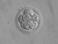 Embryo, 8 cells