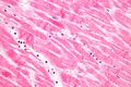 Karyolysis