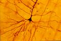 Golgi-stained pyramidal cell