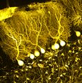 All that glitters in the brain