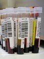 Blood test
