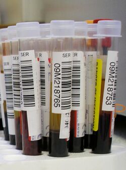 TIBC blood test vial