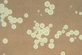 Cryptococcus neoformans using a light India ink staining preparation
