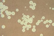 Cryptococcus neoformans using a light India ink staining preparation